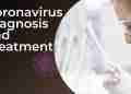 Coronavirus Diagnosis and Treatment